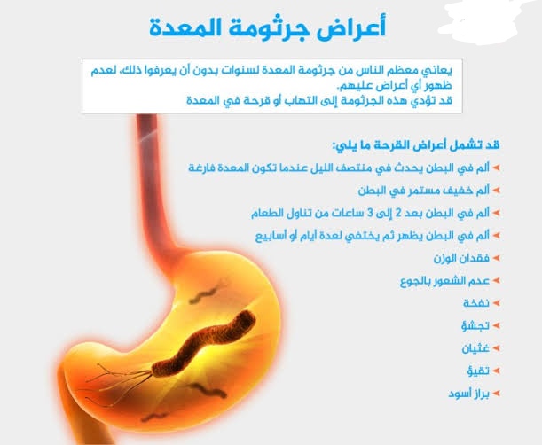 أعراض جرثومة المعدة